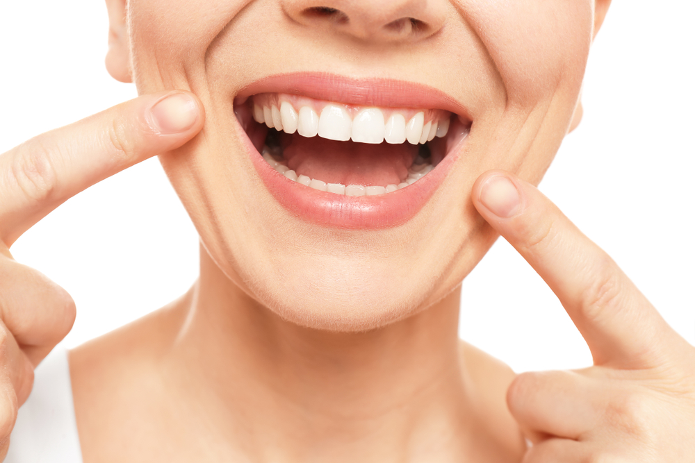 Teeth Whitening in Castle Rock